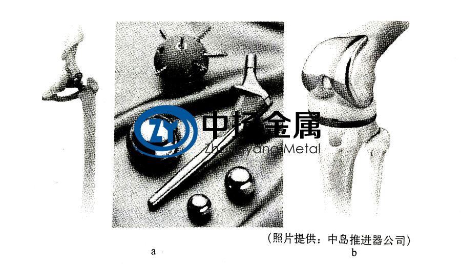 純鈦標(biāo)準(zhǔn)件在醫(yī)療領(lǐng)域的應(yīng)用案例